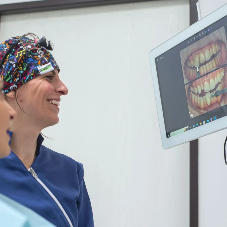 Estetica dentale a Bologna - Faccette dentali a Bologna - Come si applicano le faccette in ceramica