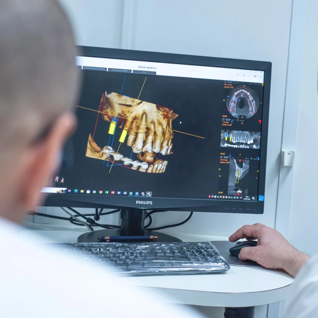 impianto dentale a Bologna